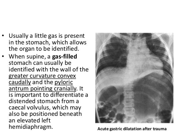 What are barium X-rays?